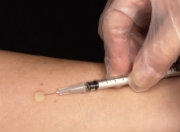 Small needle inserted under the skin.